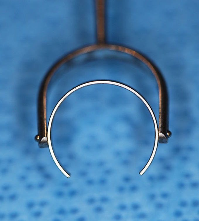 Fine thornton fixation ring