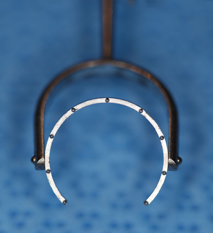 Fine thornton fixation ring